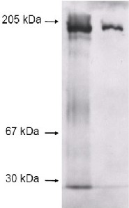 A1i3 | alpha-1-inhibitor 3 in the group Antibodies Human Cell Biology / Other proteins at Agrisera AB (Antibodies for research) (AS07 272)